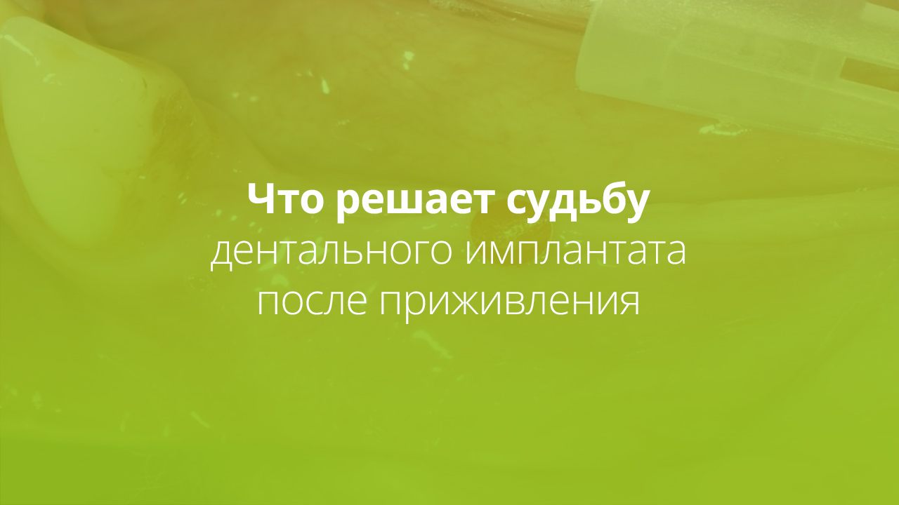 Заглавное изображение статьи о мягких тканях вокруг дентального имплантата и профилактике периимплантита